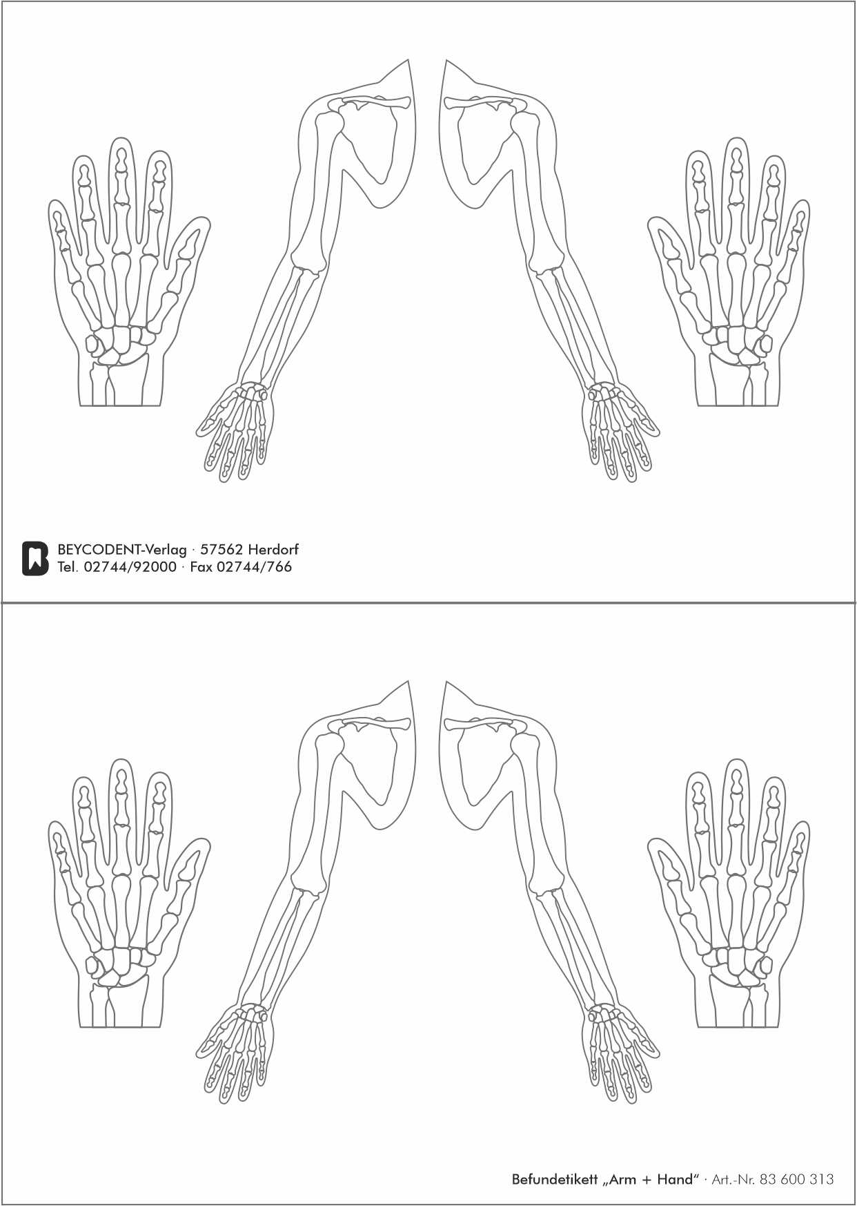 Befundetikett "Arm + Hand"