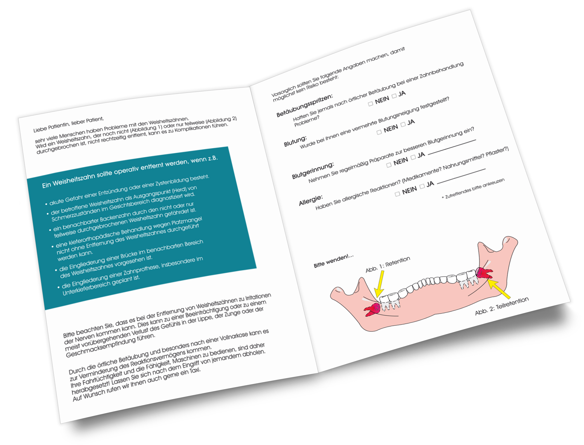 Patienten-Info Entfernung von Weisheitszähnen