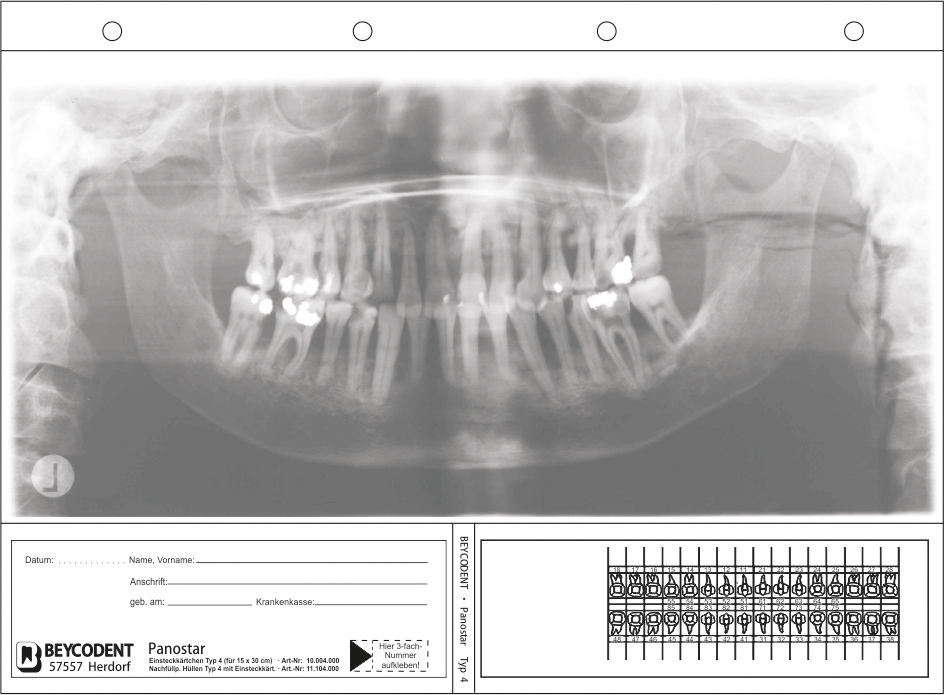 Zubehör Einsteckkarten für Panostar Typ 4
