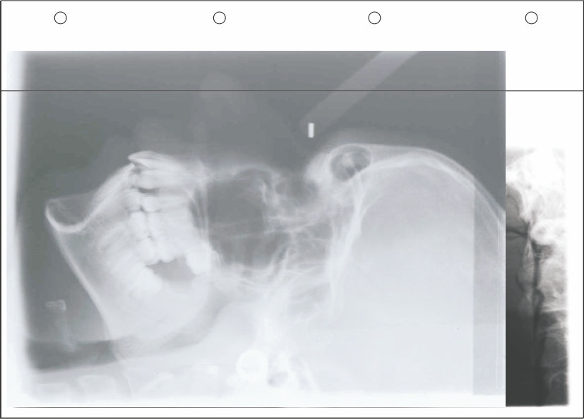 Panostar Typ 6002 INTRA-Hülle universal