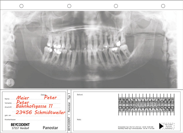 Panostar Typ 1 - Panorama-Röntgenfilm-Kartei- Nachfüllungen